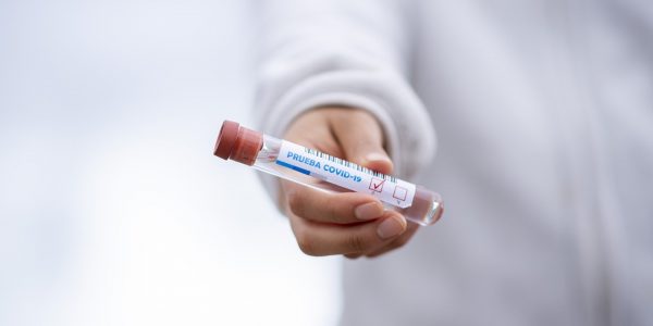 Test de Covid19 | FOTO: PIXABAY