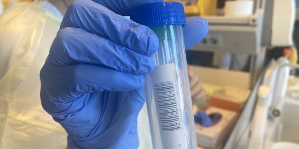 Muestra PCR | Foto: CONSEJERÍA DE SANIDAD DEL GOBIERNO DE CANARIAS
