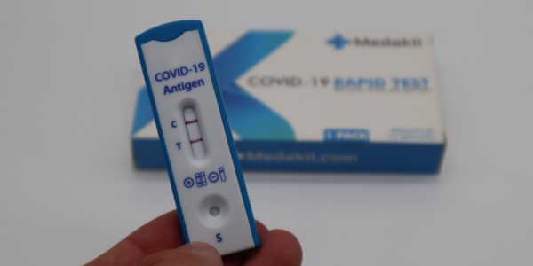 Muestra de Test de Antígenos