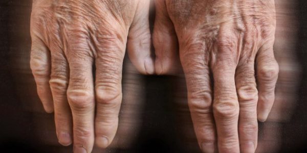 Manos de paciente de párkinson | PIXABAY