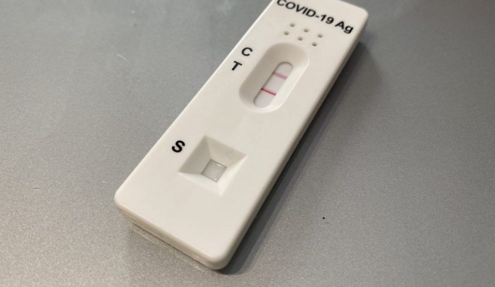 Test de antígenos para la covid