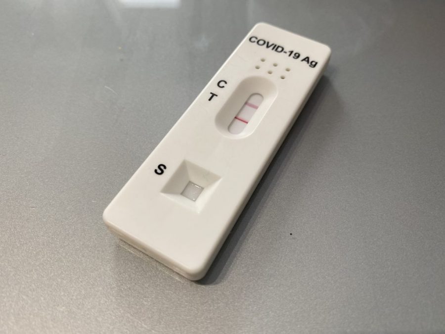 Test de antígenos para la covid Test de antígenos para la covid