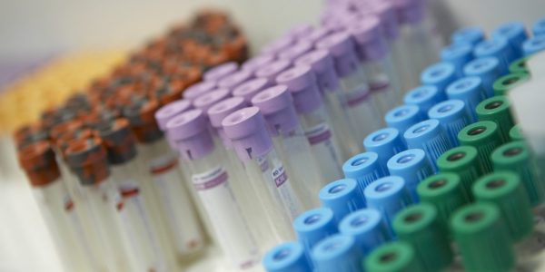 Pruebas de sangre | Foto: Consejería de Sanidad del Gobierno canario