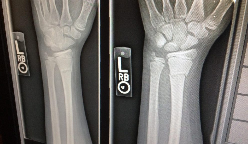 El objetivo es reducir errores diagnósticos, ajustar tratamientos y evitar valoraciones inexactas en procesos legales o de protección de menores | Foto: Pixabay